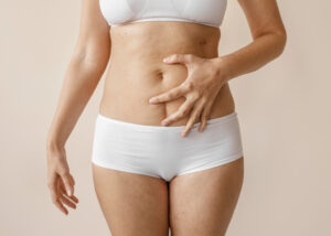 a imagem mostra uma mulher com o corpo inchado.