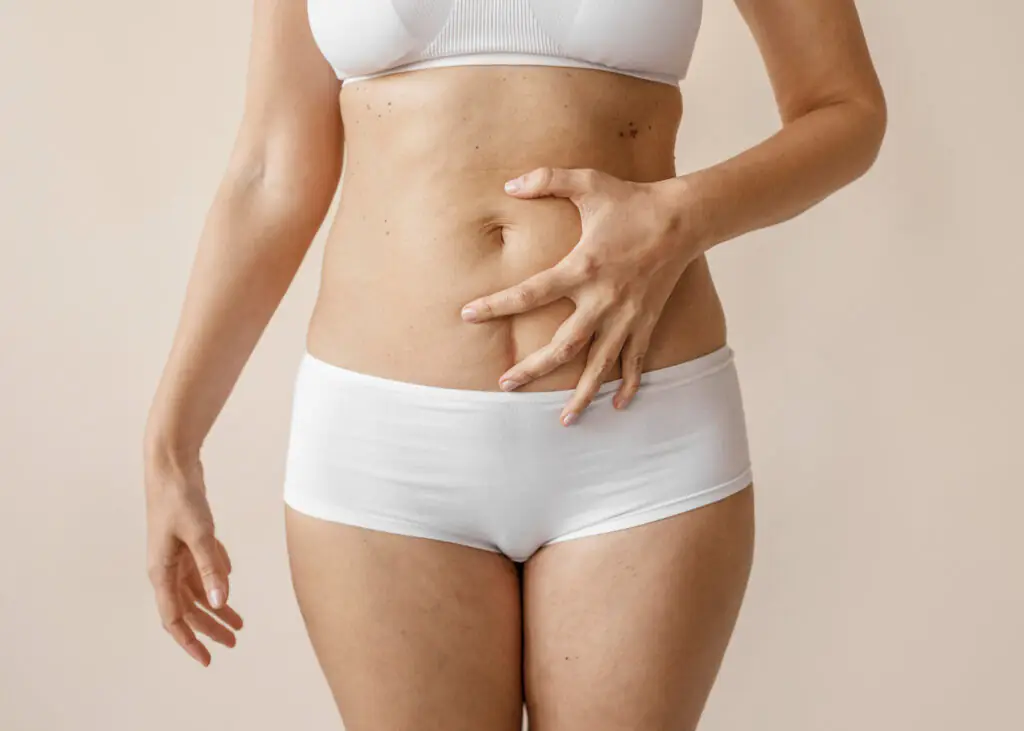 a imagem mostra uma mulher com o corpo inchado.